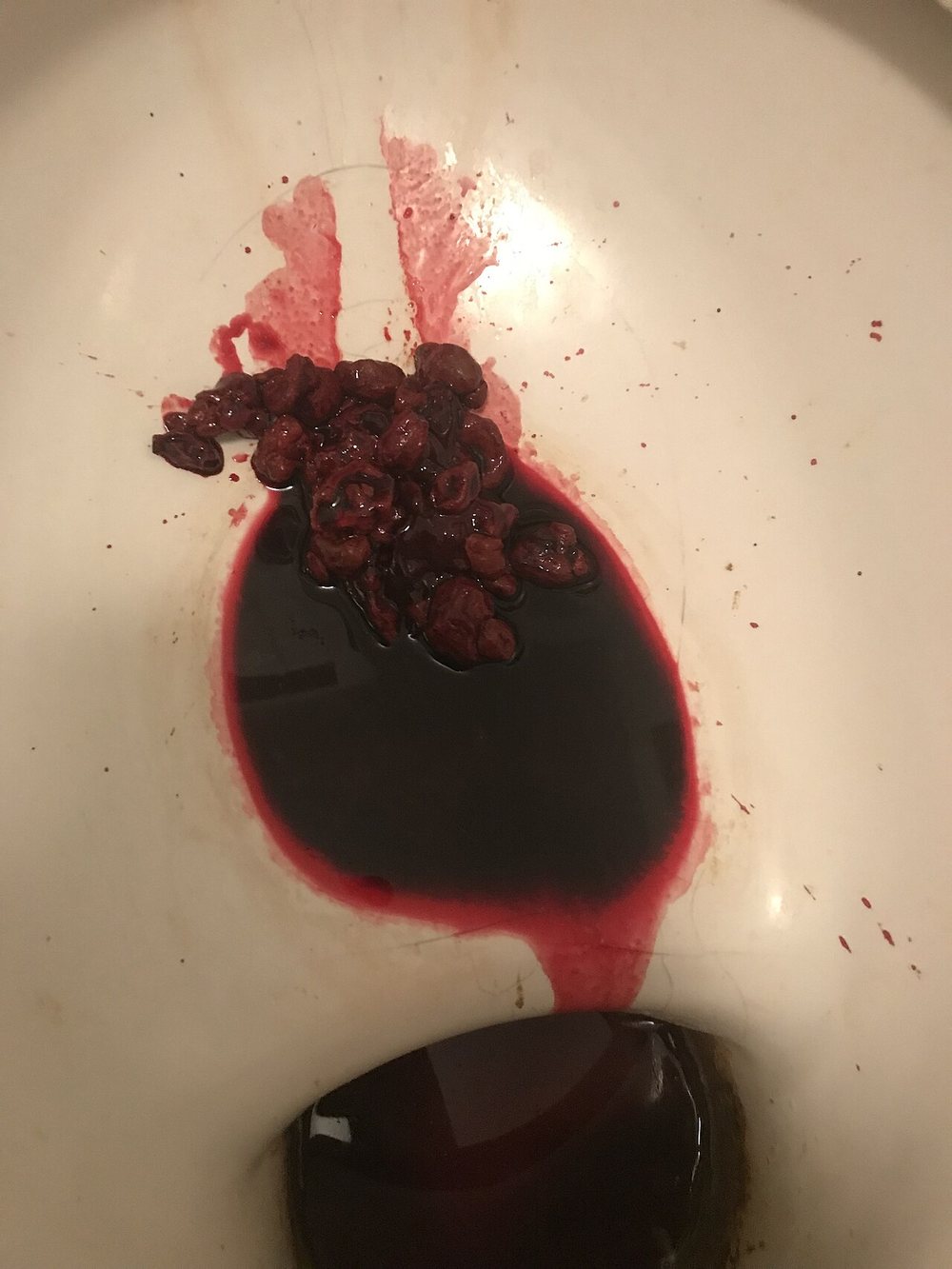 혈변(hematochezia) 임상 사진